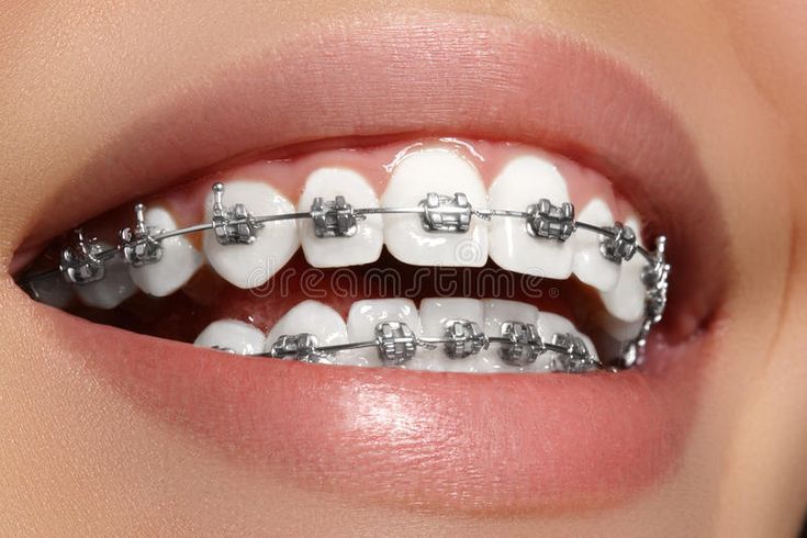 smile-img
