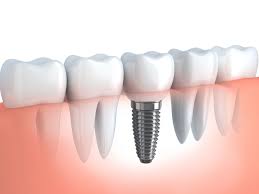 experienced & best dentist in Madipakkam